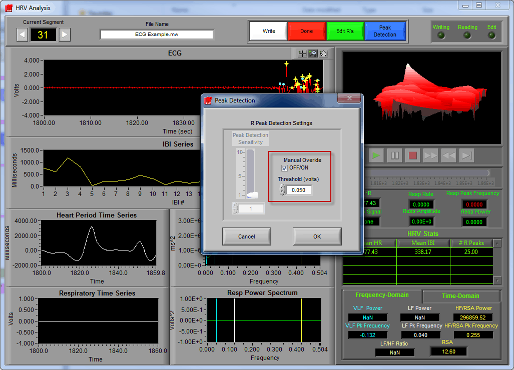 KB0034 How to Use R Peak Detection Settings MindWare Technologies