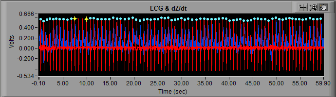 ECG Screenshot