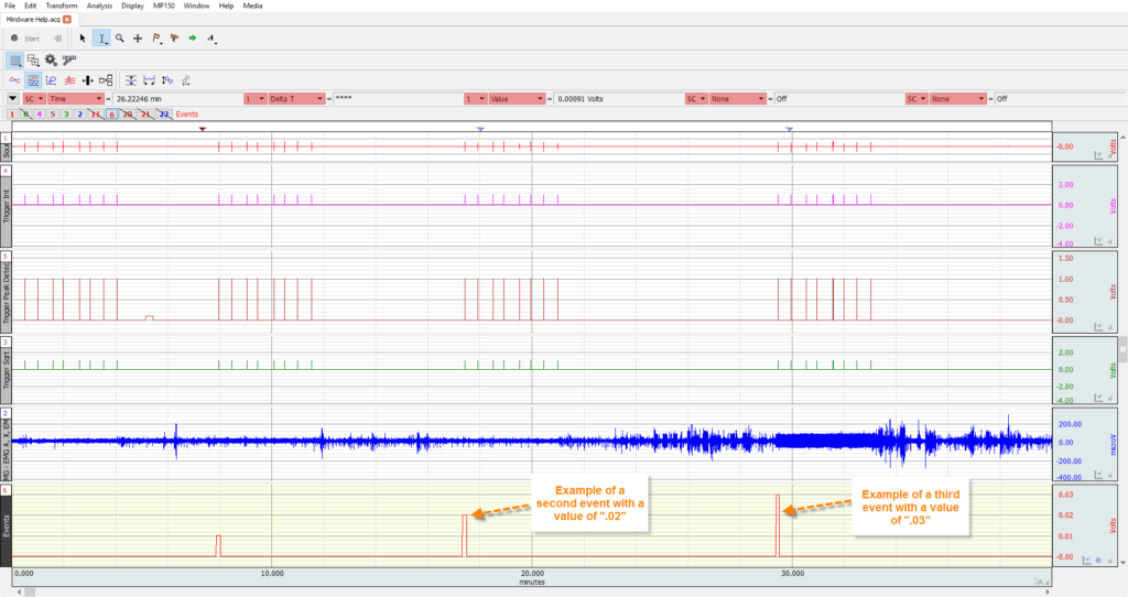 KB0007: Using AcqKnowledge Event Markers – MindWare Technologies Support