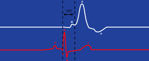 All About Cardiac Impedance Part 4: Systolic Time Intervals & – MindWare Technologies Support