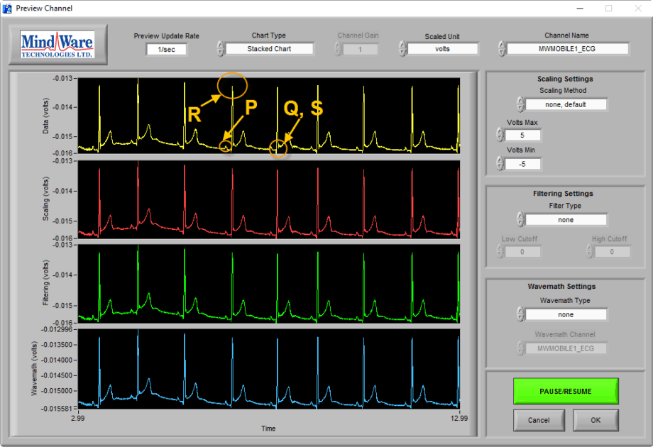 Improving Data Quality ECG MindWare Technologies Support