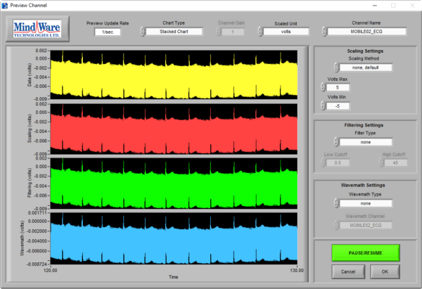 Mindware Training Module Ecg Improving Data Quality: ECG – MindWare Technologies Support