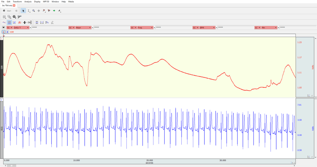 KB0048: Reading AcqKnowledge Files in MindWare Analysis Applications ...